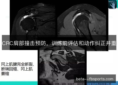 CRC肩部撞击预防，训练前评估和动作纠正并重